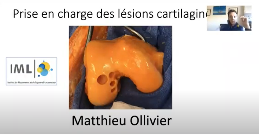 Chirurgie du cartilage approche moderne à la carte