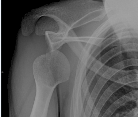 Notre zone d'activité pour ce service Chirurgien spécialiste des opérations des tendons de l'épaule près de Salon-de-Provence