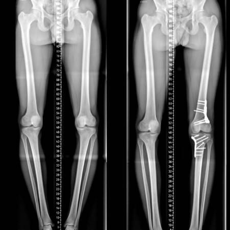 Nos prestations sur le secteur de à Bastia en Corse