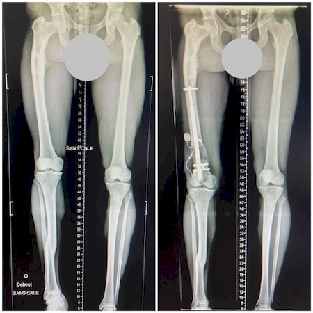 Notre zone d'activité pour ce service Prendre rendez-vous avec un chirurgien orthopédiste près d'Aix-en-Provence