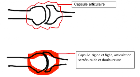 Notre zone d'activité pour ce service Réalisation de soins post opératoires au genou proche d'Avignon dans le Vaucluse